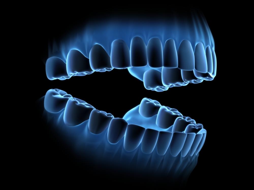 3d Printed Denture Teeth In Dental Autonomy